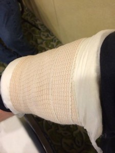 Cinch-Tight on my arm, applied by my training partner.